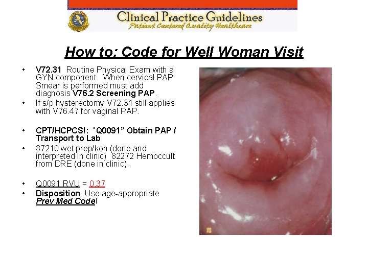 How to: Code for Well Woman Visit • • • V 72. 31 Routine