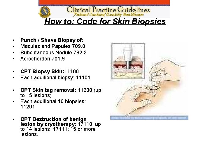 How to: Code for Skin Biopsies • • Punch / Shave Biopsy of: Macules