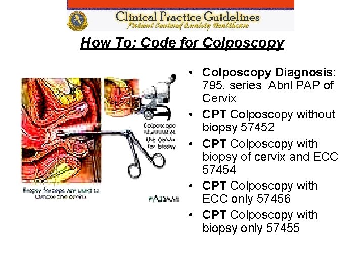 How To: Code for Colposcopy • Colposcopy Diagnosis: 795. series Abnl PAP of Cervix