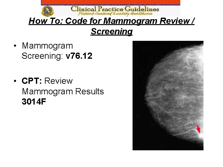 How To: Code for Mammogram Review / Screening • Mammogram Screening: v 76. 12