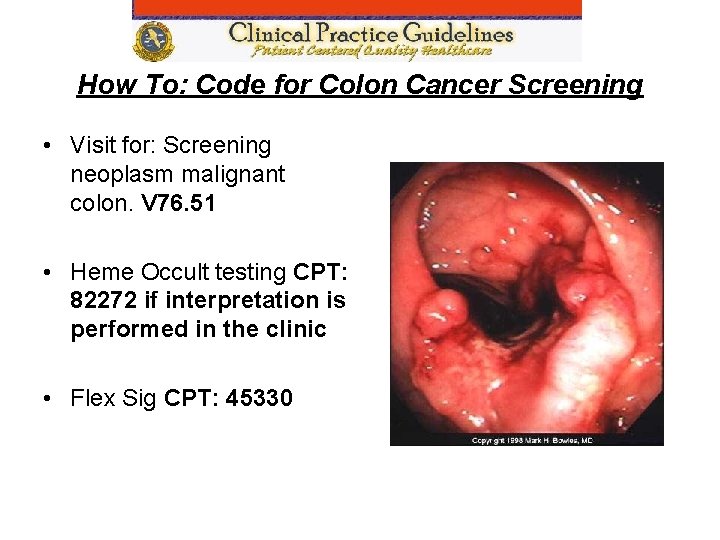 How To: Code for Colon Cancer Screening • Visit for: Screening neoplasm malignant colon.