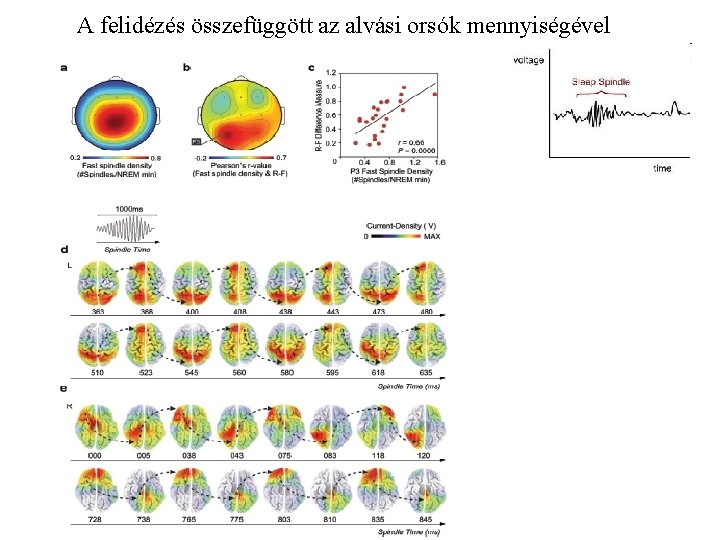 A felidézés összefüggött az alvási orsók mennyiségével 