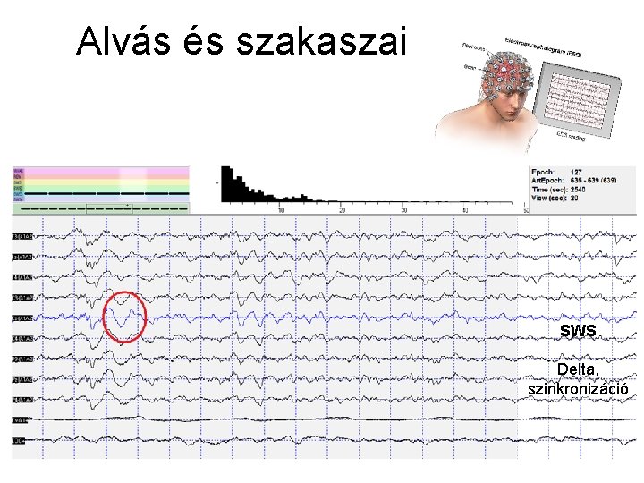 Alvás és szakaszai SWS Delta, szinkronizáció 