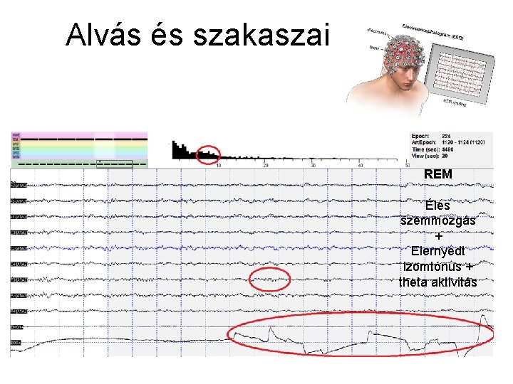 Alvás és szakaszai REM Éles szemmozgás + Elernyedt izomtónus + theta aktivitás 