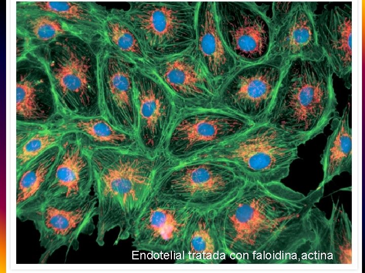 Endotelial tratada con faloidina, actina 