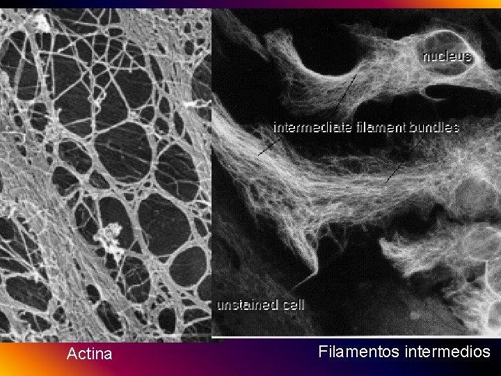 Actina Filamentos intermedios 