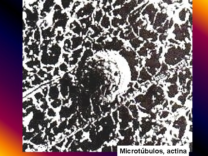 Microtúbulos, actina 