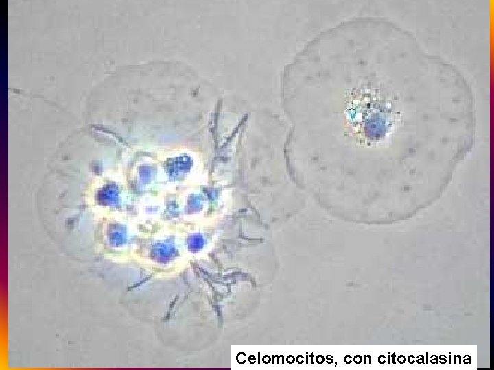 Celomocitos, con citocalasina 