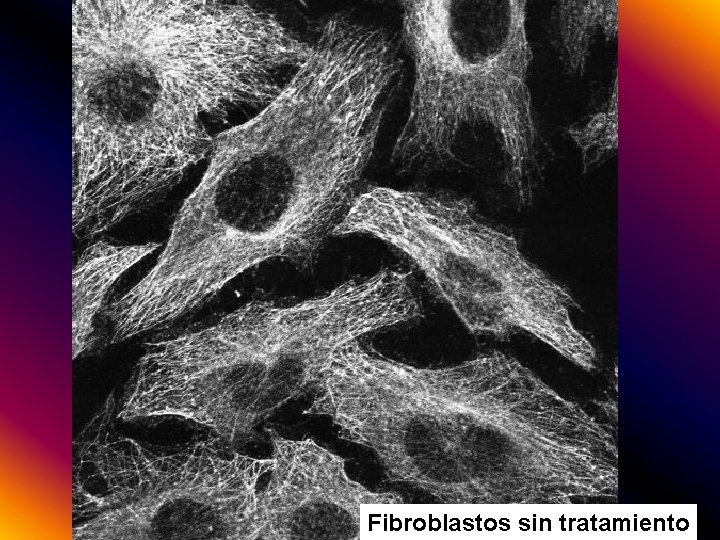 Fibroblastos sin tratamiento 