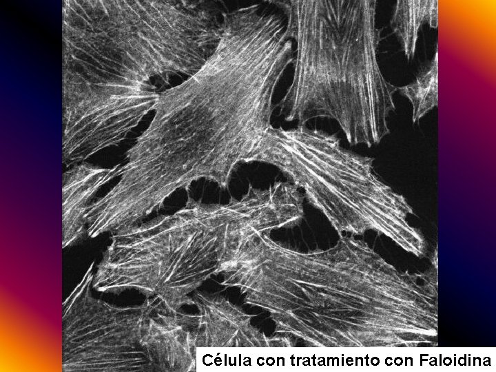 Célula con tratamiento con Faloidina 