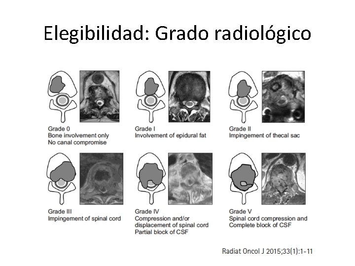 Elegibilidad: Grado radiológico 