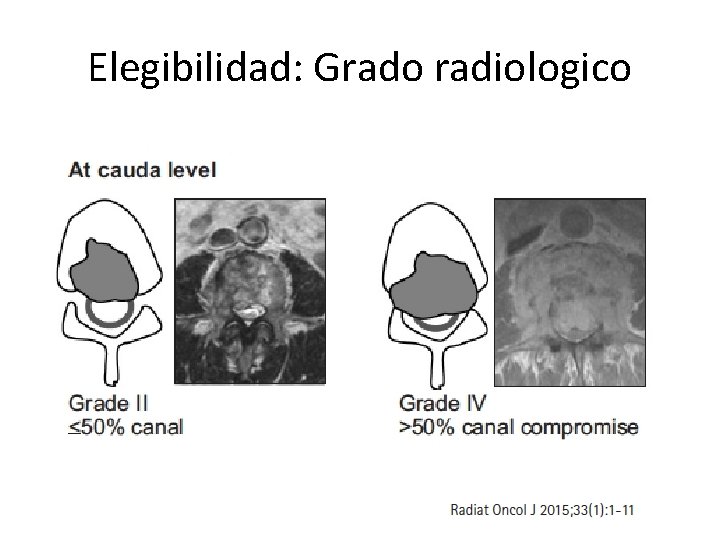 Elegibilidad: Grado radiologico 