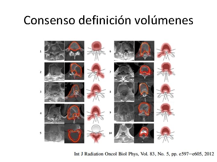 Consenso definición volúmenes 