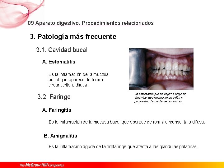 09 Aparato digestivo. Procedimientos relacionados 3. Patología más frecuente 3. 1. Cavidad bucal A.