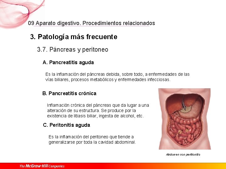 09 Aparato digestivo. Procedimientos relacionados 3. Patología más frecuente 3. 7. Páncreas y peritoneo