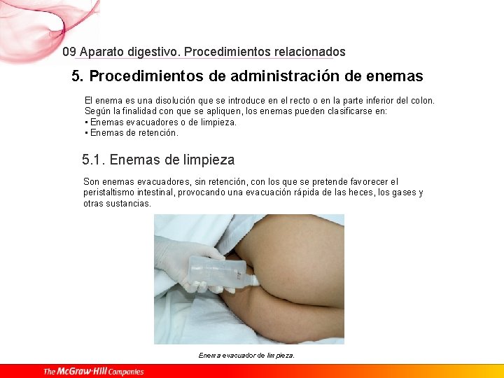 09 Aparato digestivo. Procedimientos relacionados 5. Procedimientos de administración de enemas El enema es