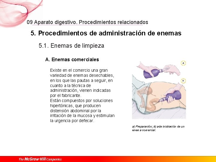 09 Aparato digestivo. Procedimientos relacionados 5. Procedimientos de administración de enemas 5. 1. Enemas