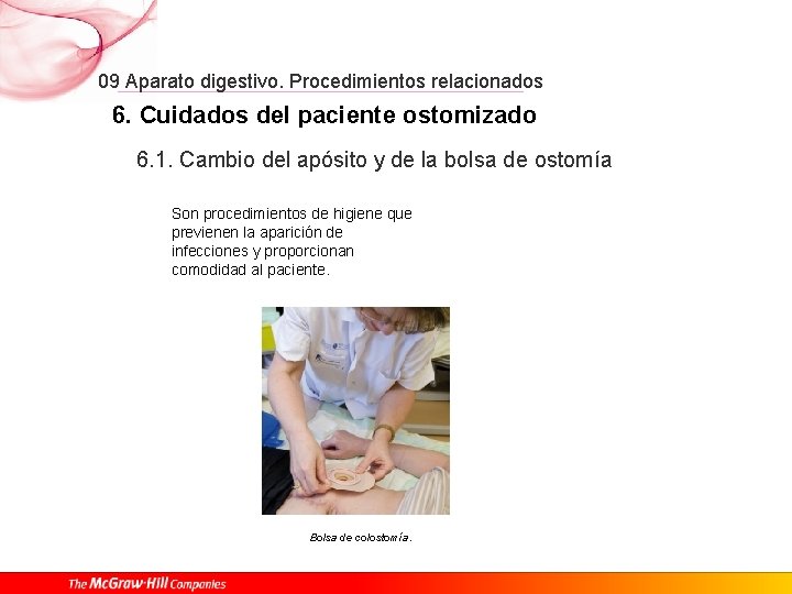 09 Aparato digestivo. Procedimientos relacionados 6. Cuidados del paciente ostomizado 6. 1. Cambio del