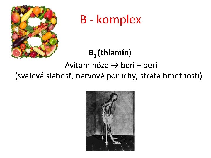 B - komplex B 1 (thiamín) Avitaminóza → beri – beri (svalová slabosť, nervové