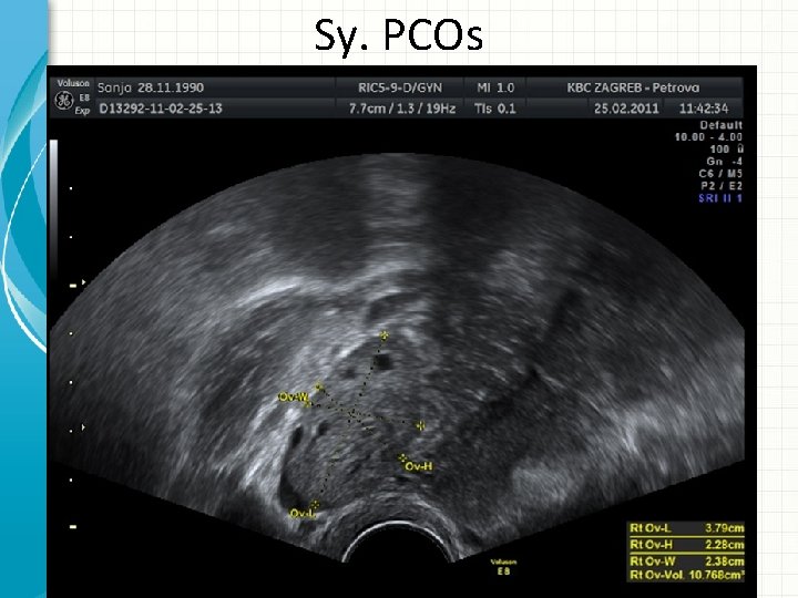 Sy. PCOs 