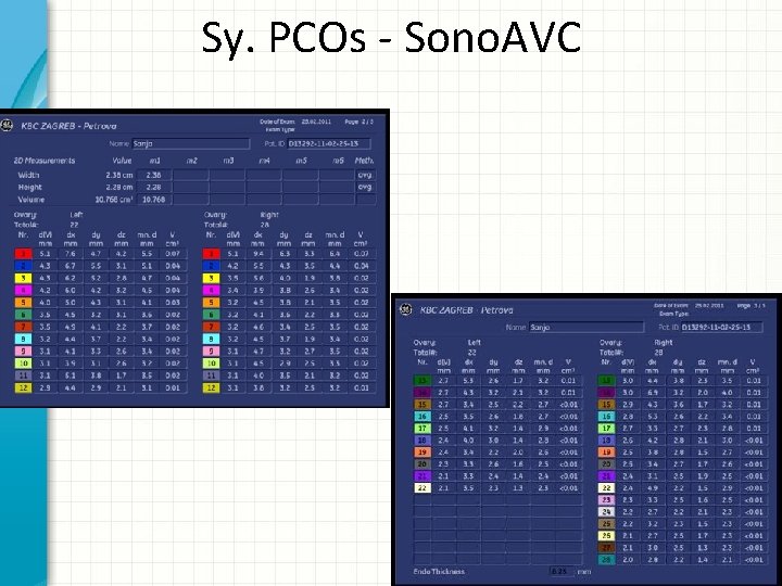 Sy. PCOs - Sono. AVC 