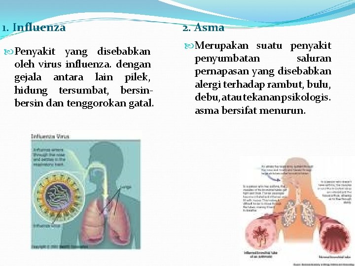 1. Influenza 2. Asma Penyakit yang disebabkan oleh virus influenza. dengan gejala antara lain