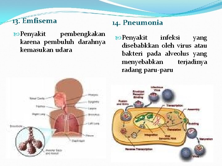 13. Emfisema Penyakit pembengkakan karena pembuluh darahnya kemasukan udara 14. Pneumonia Penyakit infeksi yang