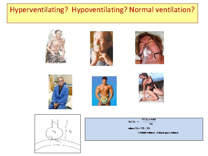 Hyperventilating? Hypoventilating? Normal ventilation? Pa. CO 2 = VCO 2 x 0. 863 --------VA