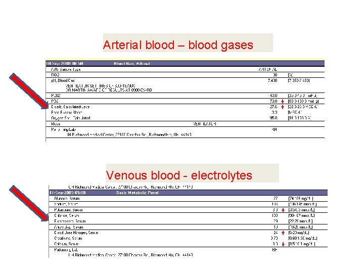 Arterial blood – blood gases Venous blood - electrolytes 