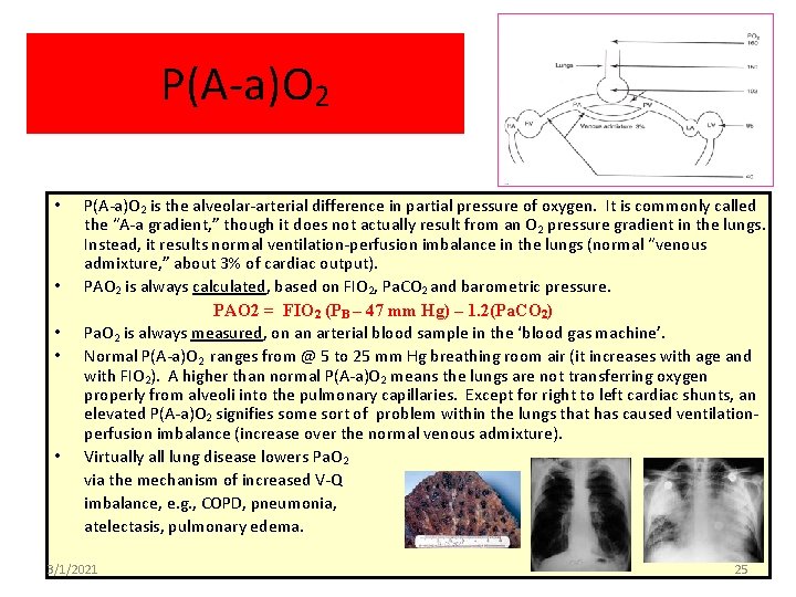 P(A-a)O 2 • • • P(A-a)O 2 is the alveolar-arterial difference in partial pressure