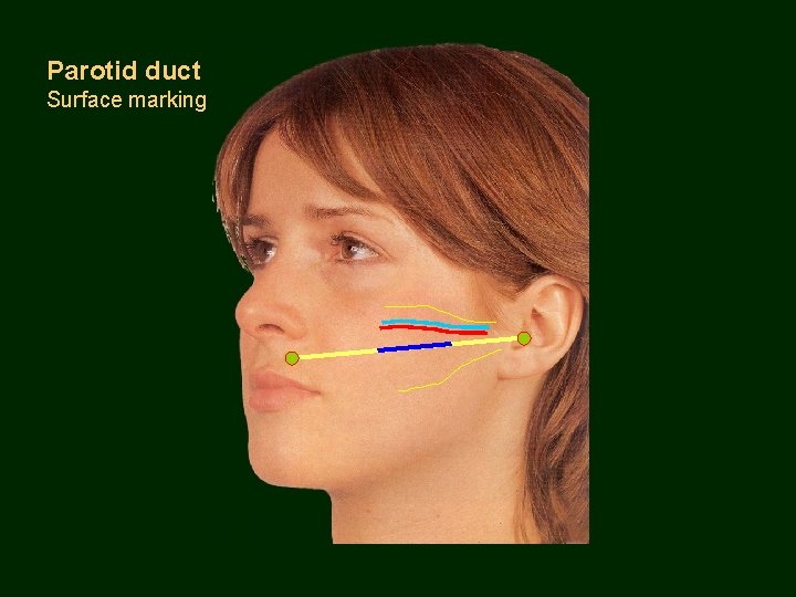 Parotid duct Surface marking 