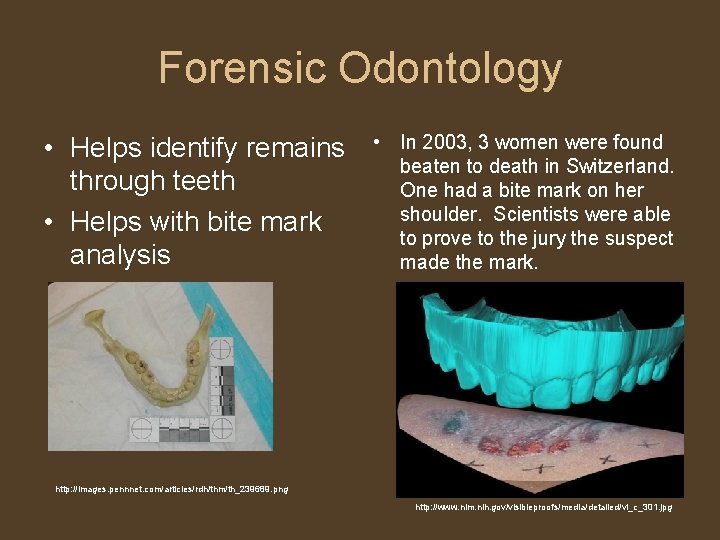 Forensic Odontology • Helps identify remains through teeth • Helps with bite mark analysis