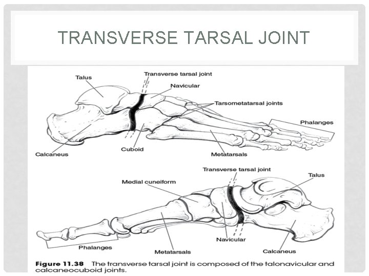 TRANSVERSE TARSAL JOINT 