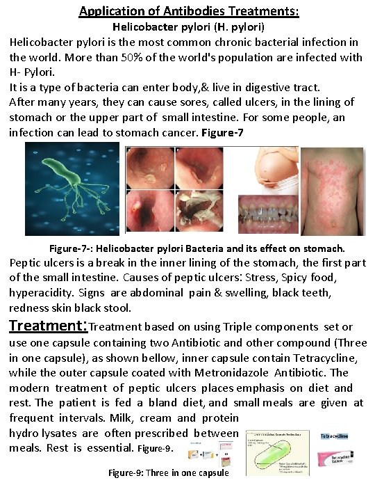 Application of Antibodies Treatments: Helicobacter pylori (H. pylori) Helicobacter pylori is the most common