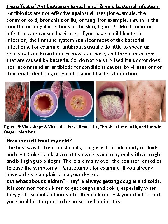 The effect of Antibiotics on fungal, viral & mild bacterial infection: Antibiotics are not