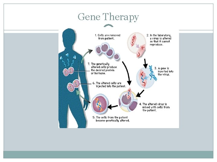 Gene Therapy 