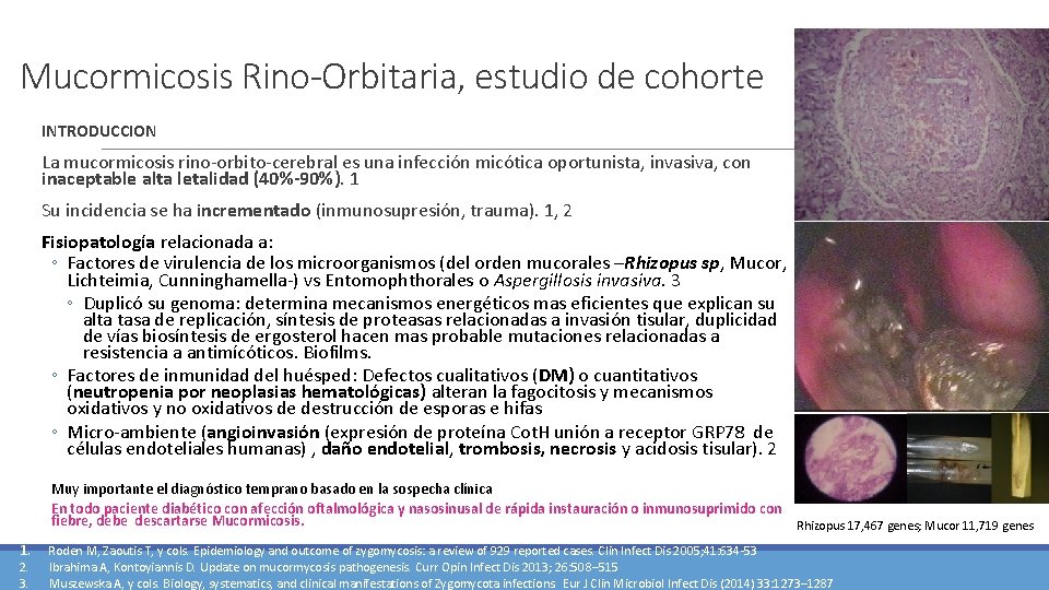 Mucormicosis Rino-Orbitaria, estudio de cohorte INTRODUCCION La mucormicosis rino-orbito-cerebral es una infección micótica oportunista,