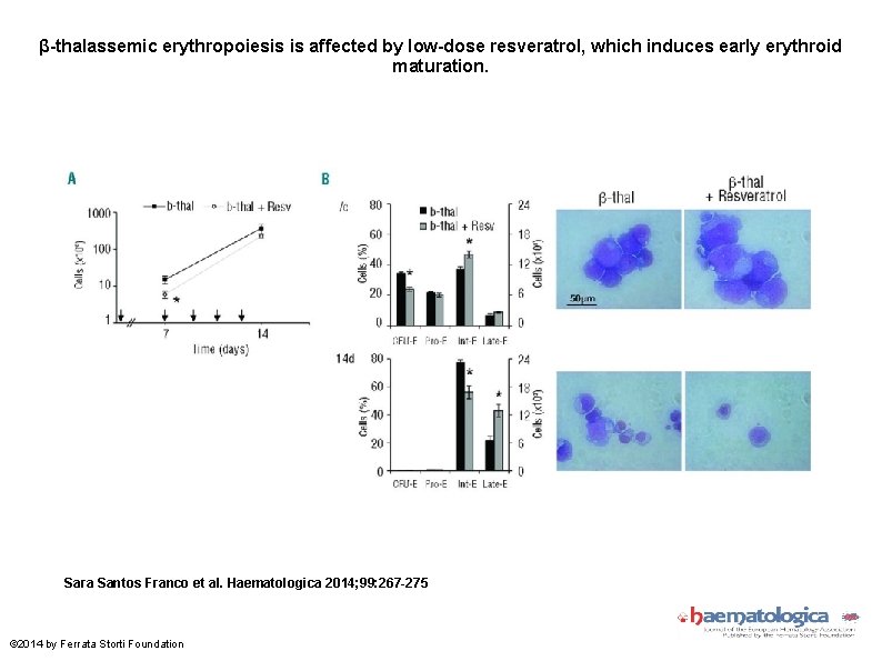 β-thalassemic erythropoiesis is affected by low-dose resveratrol, which induces early erythroid maturation. Sara Santos