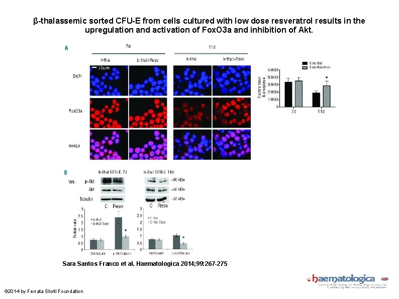 β-thalassemic sorted CFU-E from cells cultured with low dose resveratrol results in the upregulation