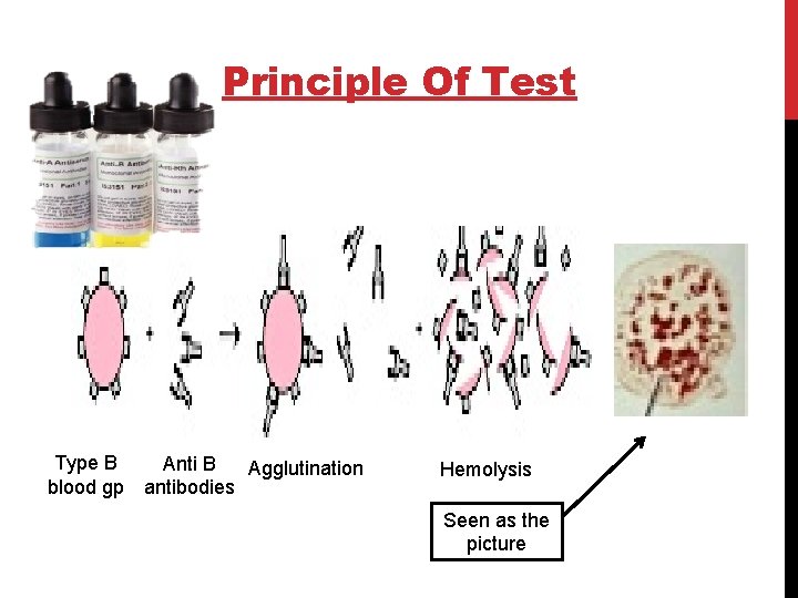 Principle Of Test Type B blood gp Anti B Agglutination antibodies Hemolysis Seen as