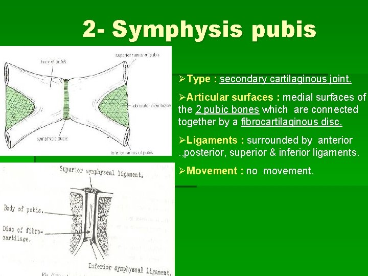 2 - Symphysis pubis ØType : secondary cartilaginous joint. ØArticular surfaces : medial surfaces