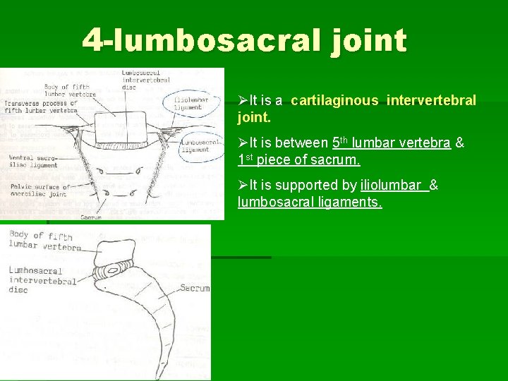 4 -lumbosacral joint ØIt is a cartilaginous intervertebral joint. ØIt is between 5 th