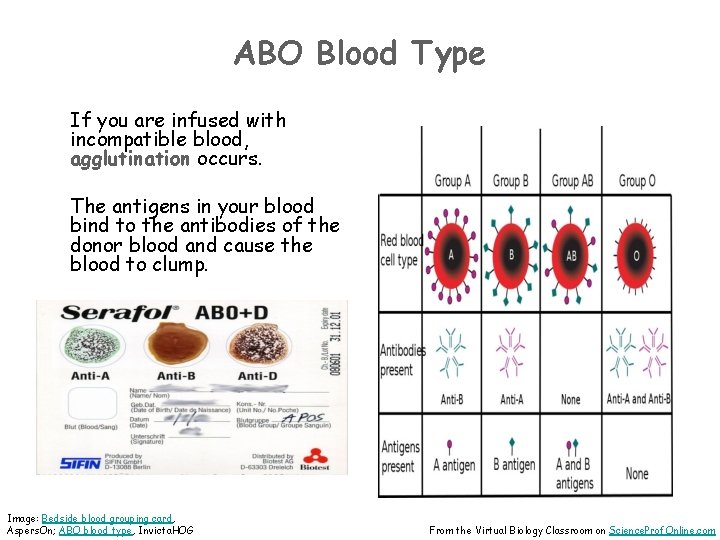 ABO Blood Type If you are infused with incompatible blood, agglutination occurs. The antigens