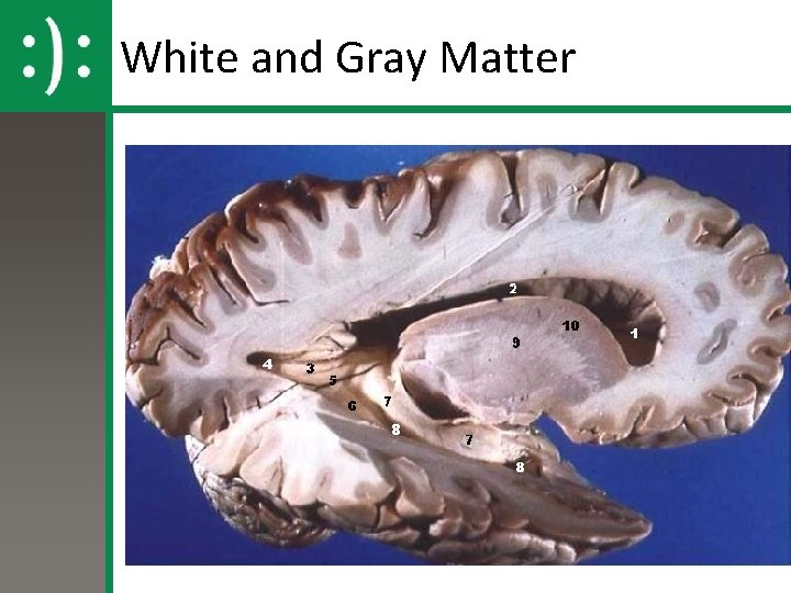 White and Gray Matter 