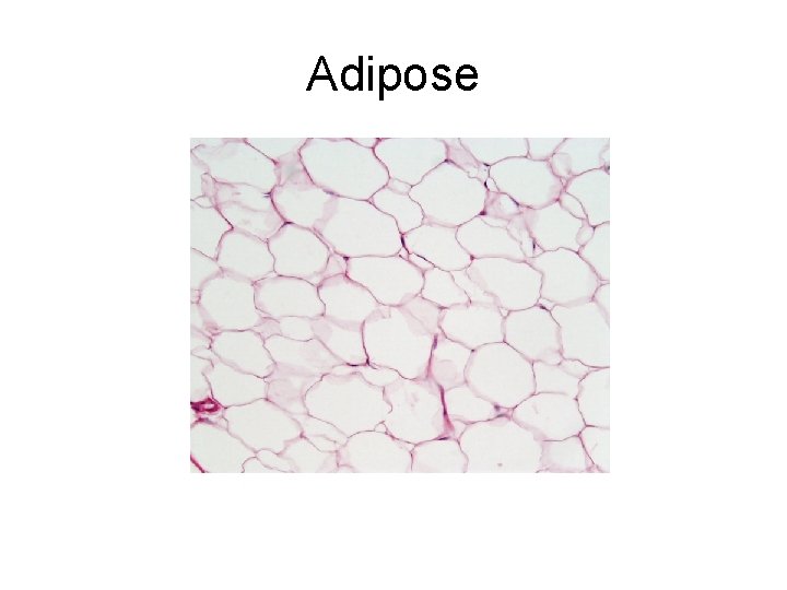 Adipose 