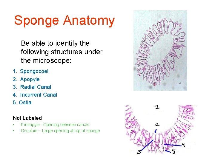 Sponge Anatomy Be able to identify the following structures under the microscope: 1. Spongocoel