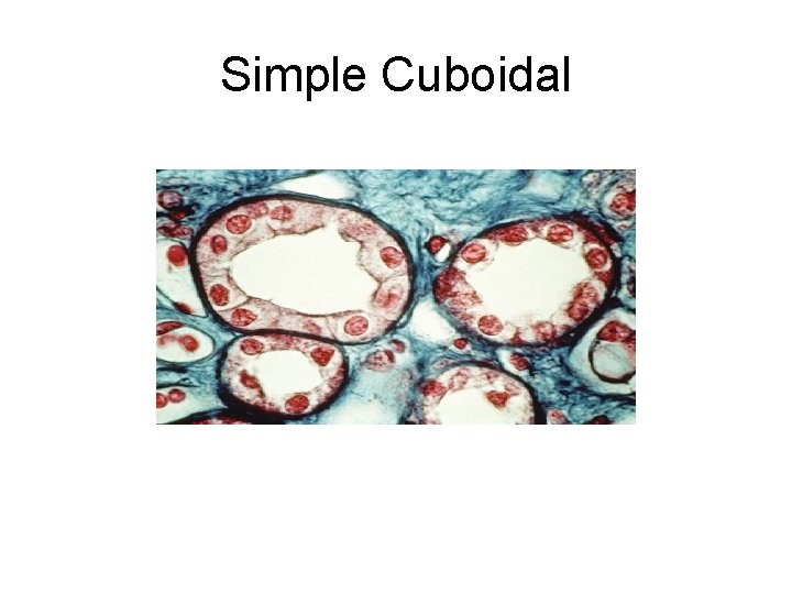 Simple Cuboidal 