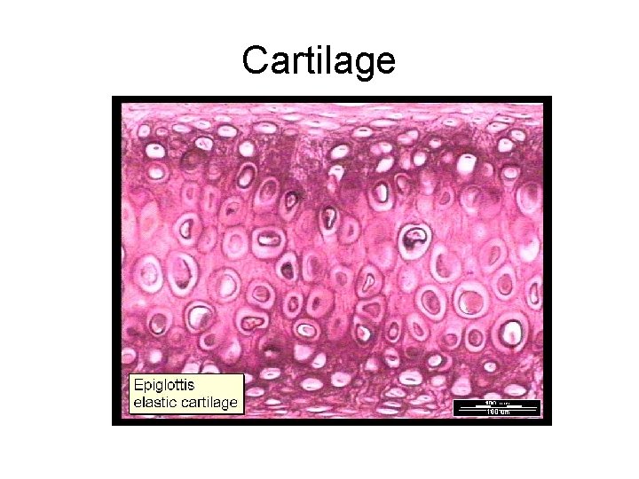 Cartilage 
