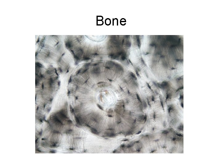 Bone 