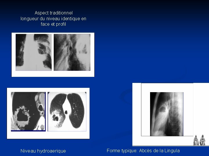 Aspect traditionnel longueur du niveau identique en face et profil Niveau hydroaerique Forme typique: